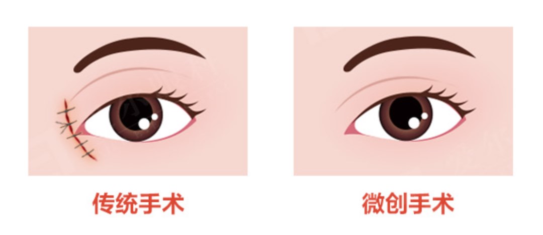 图片.png 图片.png